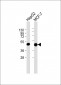 KRT19 Antibody